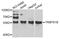 TRNA Methyltransferase 61B antibody, PA5-76336, Invitrogen Antibodies, Western Blot image 