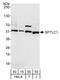 Serine palmitoyltransferase 1 antibody, A303-408A, Bethyl Labs, Western Blot image 