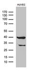 G Protein Subunit Alpha 14 antibody, M09083, Boster Biological Technology, Western Blot image 