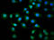 Kinesin Family Member 3C antibody, LS-C680719, Lifespan Biosciences, Immunofluorescence image 