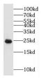GLIPR1 Like 1 antibody, FNab03480, FineTest, Western Blot image 