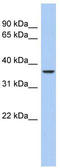 Aquaporin 10 antibody, TA342085, Origene, Western Blot image 