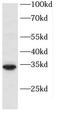 Polysaccharide Biosynthesis Domain Containing 1 antibody, FNab02110, FineTest, Western Blot image 