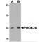 Paired mesoderm homeobox protein 2B antibody, MBS150210, MyBioSource, Western Blot image 