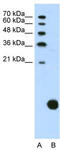 Ribosomal Protein S29 antibody, TA345755, Origene, Western Blot image 