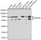 Transducin Beta Like 1 X-Linked Receptor 1 antibody, 14-990, ProSci, Western Blot image 