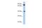 Zinc Finger Protein 429 antibody, PA5-43544, Invitrogen Antibodies, Western Blot image 