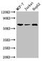 SHOC2 Leucine Rich Repeat Scaffold Protein antibody, LS-C679454, Lifespan Biosciences, Western Blot image 