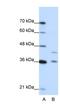 Protein naked cuticle homolog 2 antibody, NBP1-54733, Novus Biologicals, Western Blot image 