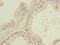LIM Domain Only 4 antibody, LS-C675998, Lifespan Biosciences, Immunohistochemistry paraffin image 