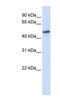 RNA Guanine-7 Methyltransferase antibody, NBP1-57390, Novus Biologicals, Western Blot image 