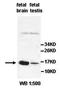 Alkaline Ceramidase 2 antibody, orb77488, Biorbyt, Western Blot image 