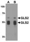 Glutaminase 2 antibody, A05334, Boster Biological Technology, Western Blot image 
