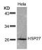 Heat Shock Protein Family B (Small) Member 1 antibody, AP02743PU-N, Origene, Western Blot image 