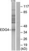 Lysophosphatidic Acid Receptor 2 antibody, TA314870, Origene, Western Blot image 