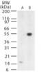 West Nile Virus antibody, NB100-56744, Novus Biologicals, Western Blot image 
