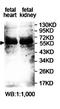 Ankyrin Repeat And Death Domain Containing 1A antibody, orb78036, Biorbyt, Western Blot image 