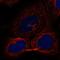 Zinc Finger DHHC-Type Containing 17 antibody, HPA016807, Atlas Antibodies, Immunocytochemistry image 