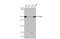 Dicer 1, Ribonuclease III antibody, GTX636580, GeneTex, Western Blot image 
