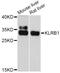 Killer Cell Lectin Like Receptor B1 antibody, LS-C747132, Lifespan Biosciences, Western Blot image 