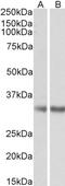 Monoglyceride Lipase antibody, TA302540, Origene, Western Blot image 