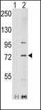 P21 (RAC1) Activated Kinase 1 antibody, MBS9208213, MyBioSource, Western Blot image 