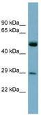 Ras-related protein Rab-27A antibody, TA342222, Origene, Western Blot image 