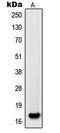 PDGF-AA antibody, LS-C352639, Lifespan Biosciences, Western Blot image 