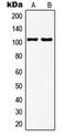 Glutamate Metabotropic Receptor 7 antibody, LS-C352284, Lifespan Biosciences, Western Blot image 
