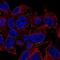 Plakophilin-4 antibody, PA5-67116, Invitrogen Antibodies, Immunofluorescence image 