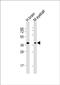 Arrestin 3 antibody, PA5-49513, Invitrogen Antibodies, Western Blot image 