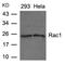 Rac Family Small GTPase 1 antibody, A00041, Boster Biological Technology, Western Blot image 