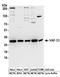 Vesicle-associated membrane protein-associated protein A antibody, A304-366A, Bethyl Labs, Western Blot image 