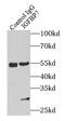 Insulin Like Growth Factor Binding Protein 7 antibody, FNab04181, FineTest, Immunoprecipitation image 