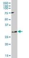 Potassium Voltage-Gated Channel Interacting Protein 2 antibody, H00030819-B01P, Novus Biologicals, Western Blot image 