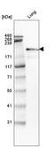 Laminin Subunit Beta 2 antibody, AMAb91097, Atlas Antibodies, Western Blot image 