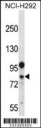 DEAD-Box Helicase 3 Y-Linked antibody, 56-646, ProSci, Western Blot image 