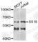 SS18 Subunit Of BAF Chromatin Remodeling Complex antibody, A6990, ABclonal Technology, Western Blot image 