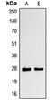 Paired Related Homeobox 1 antibody, orb214412, Biorbyt, Western Blot image 