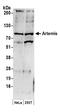 Protein artemis antibody, A300-234A, Bethyl Labs, Western Blot image 
