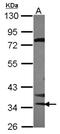 Serine/Threonine Kinase 16 antibody, NBP2-20514, Novus Biologicals, Western Blot image 