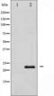 Vascular Endothelial Growth Factor B antibody, TA325971, Origene, Western Blot image 