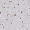 Histone-lysine N-methyltransferase SETD1A antibody, PA5-54254, Invitrogen Antibodies, Immunohistochemistry frozen image 