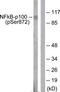 Nuclear factor NF-kappa-B p100 subunit antibody, TA314253, Origene, Western Blot image 