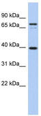Membrane Spanning 4-Domains A14 antibody, TA339616, Origene, Western Blot image 