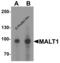 MALT1 antibody, 8097, ProSci, Western Blot image 