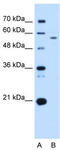 UBX Domain Protein 4 antibody, TA342448, Origene, Western Blot image 