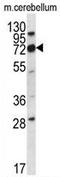 Immunoglobulin superfamily member 8 antibody, AP52177PU-N, Origene, Western Blot image 