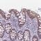 RING finger protein 170 antibody, HPA050931, Atlas Antibodies, Immunohistochemistry paraffin image 