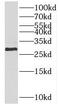 Palmitoyl-Protein Thioesterase 2 antibody, FNab06740, FineTest, Western Blot image 